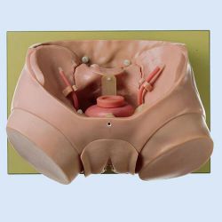 Bladder Phantom for Endoscopic Examination