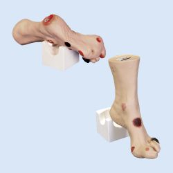 Wilma Wound Foot Care Model